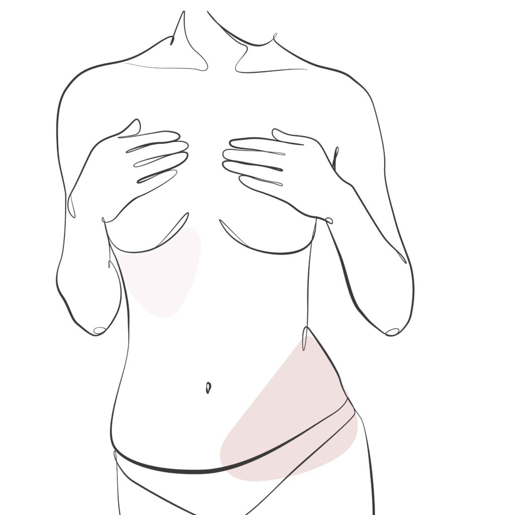Procedure image