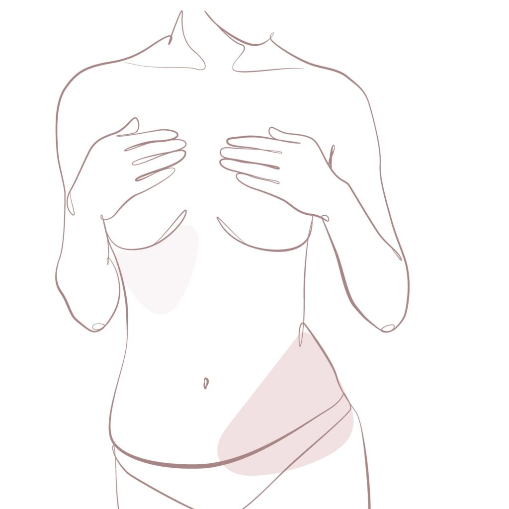 Procedure image